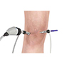 Arthroscopic Reconstruction of the Knee for Ligament Injuries