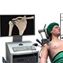 Minimally Invasive Shoulder Joint Replacement