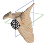 Virtual Implant Positioning by Arthrex